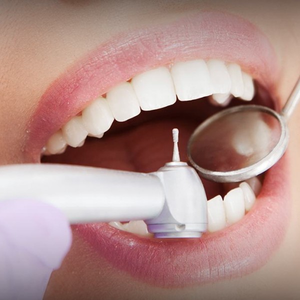 Dentística na OdontoCompany Jaçanã